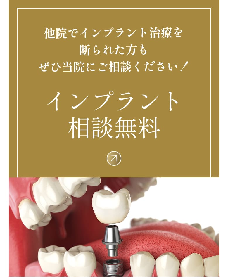 他院でインプラント治療を断られた方もぜひ当院にご相談ください！インプラント相談無料